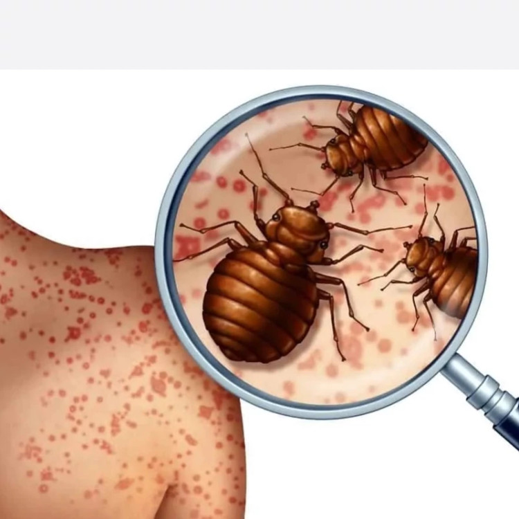 سم ساس پرو مکث رقیب ساس های خونخوار ارسال رایگان
