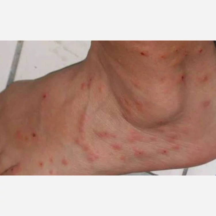 سم کنه کبوتری بلک فلگ قوی ترین سم برای کنه کبوتری یک لیتری ارسال رایگان