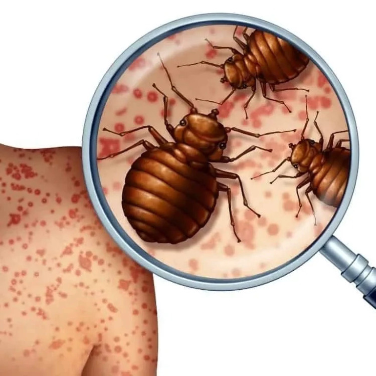 سم ساس کش پیرانا نسخه اصلی h به شرط مرجوعی کالا بدون بو