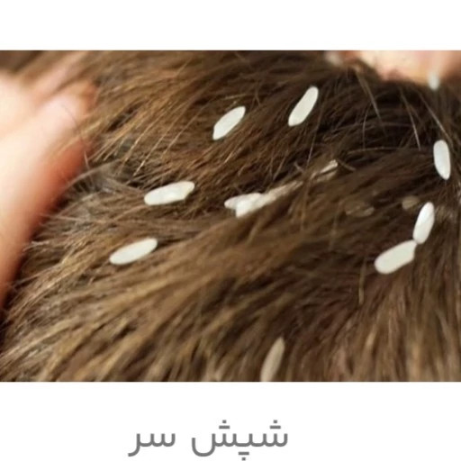 سم شپش کش پرمکترین مبارز قوی شپش موی سر و محیط