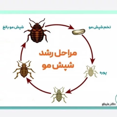 سم شپش کش مو و محیط پرمکترین مبارز قوی شپش ارسال رایگان